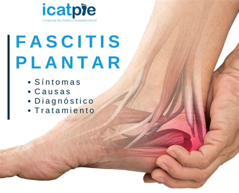 Fascitis Plantar Diagnóstico Síntomas Y Tratamiento