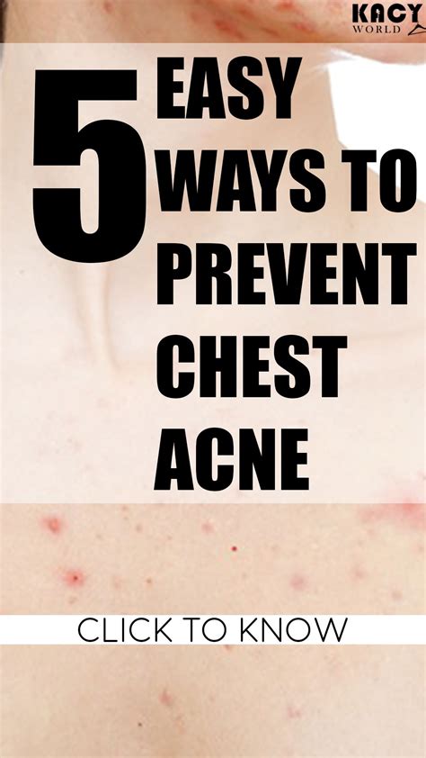 Read my story to see what worked and what changed my life. How To Get Rid Of Chest Acne Quickly | Chest acne, Acne ...