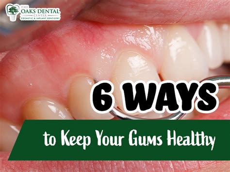 6 Ways To Keep Your Gums Healthy The Oaks Dental Center