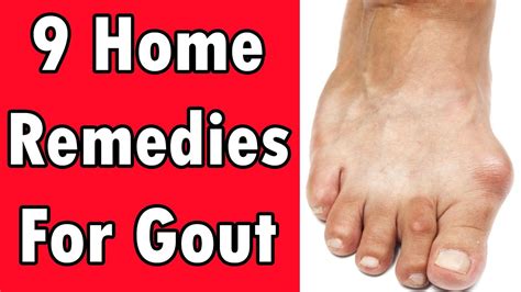 9 Home Remedies For Gout Youtube