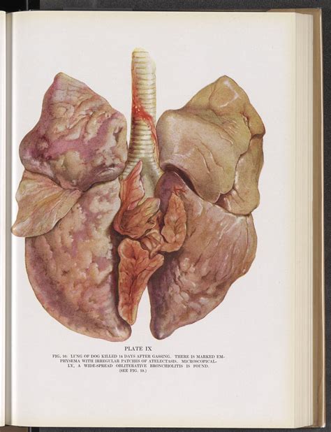 Plate Ix Fig 16 Lung Of Dog Killed 14 Days After Gassing Science