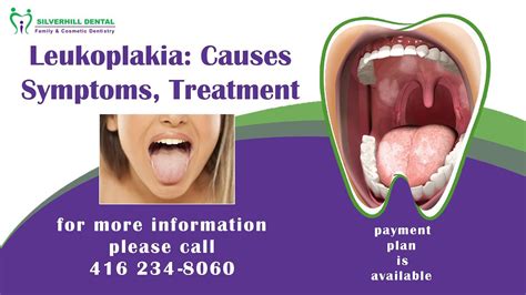 Silverhill Dental Leukoplakia Causes Symptoms Treatment Youtube