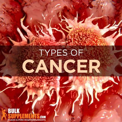 What Is Cancer Causes Symptoms Stages And Treatment