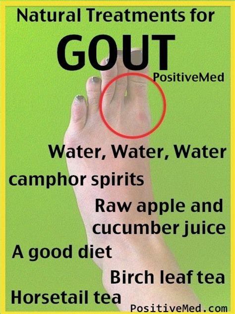 Pin By Janet Stang On Taking Care Of Me Natural Remedies For Gout
