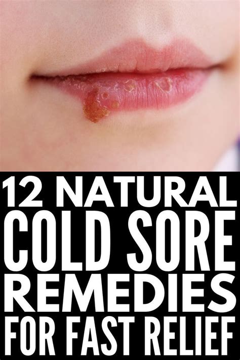 How To Cover Up A Cold Sore On Your Lip Nikki Salcedo
