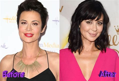 Catherine Bell Plastic Surgery Rumors Any Truth Behind It