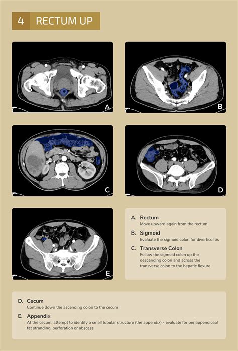 Differential Diagnosis Of Infographic CT Abdomen Pelvis Interpretation