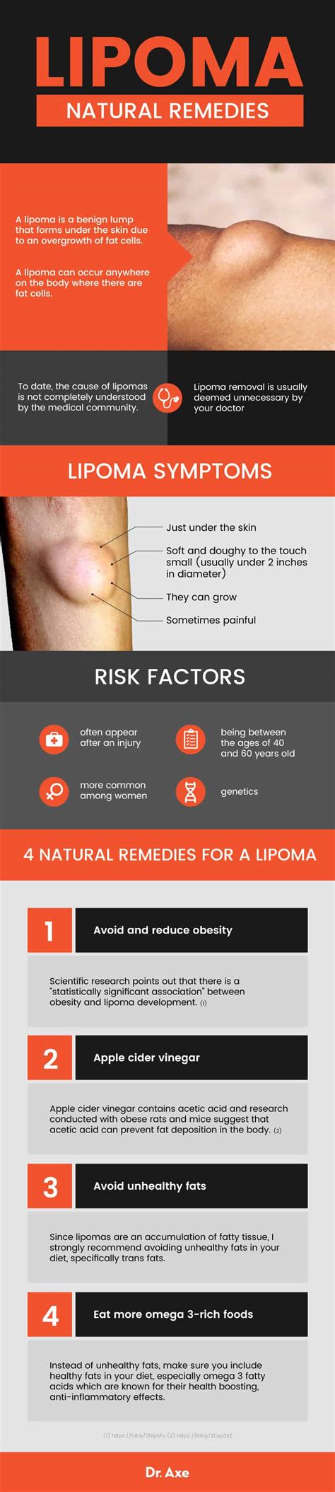 What Is A Lipoma Symptoms Causes 4 Natural Remedies Best Pure