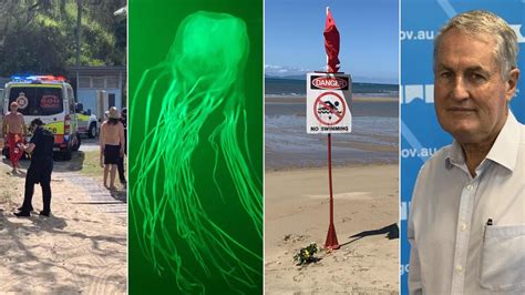 Mackay Datal Box Jellyfish Sting What To Do If Stung Explainer The