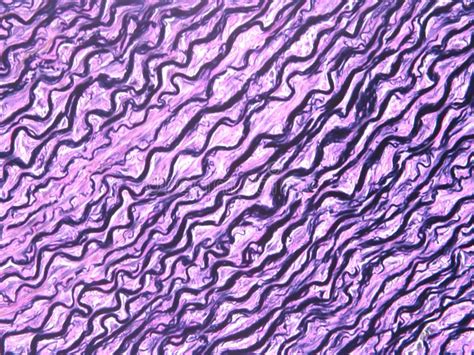 Elastic Tissue Seen Through A Microscope Stock Image Image Of Black