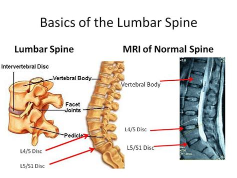 Understanding Your Lumbar Spine Mri Centeno Schultz Clinic