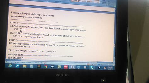 Acute appendicitis is typically a disease of children and young adults with a peak incidence in the 2nd to 3rd decades of life 1. ICD-10 JJ-10A-292-11-L1 acute lymphangitis - YouTube