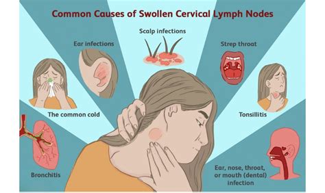 Is There A Link Between Swollen Lymph Nodes And Dental Issues