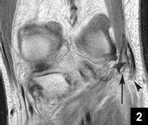 Your Diagnosis?