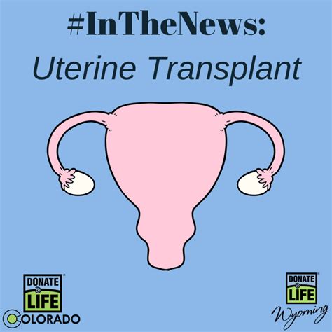 In The News Uterine Transplant