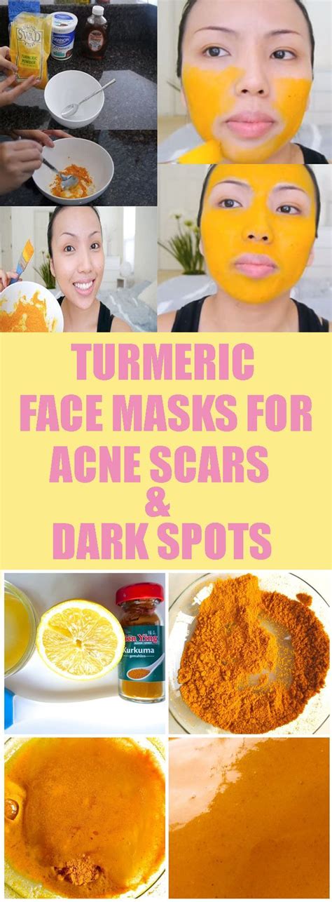 The Best Homemade Facial Masks Acne Scar Mask Turmeric Face Mask