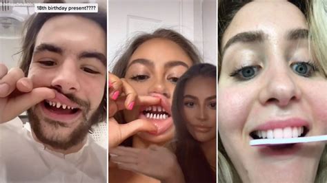 Tiktok Teeth Shaving Trending Videos Gallery Know Your Meme