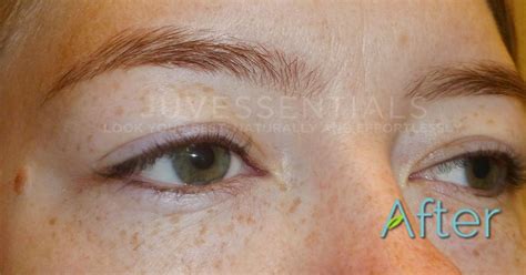 Articles on our website about the efforts of nonprofits, companies and individuals who are working in this area. Eyes - JuvEssentials is #1 Rated for Cosmetic Tattooing ...