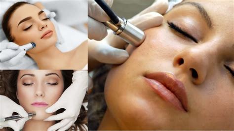 Surprising Benefits Of Microdermabrasion Benefits And Uses