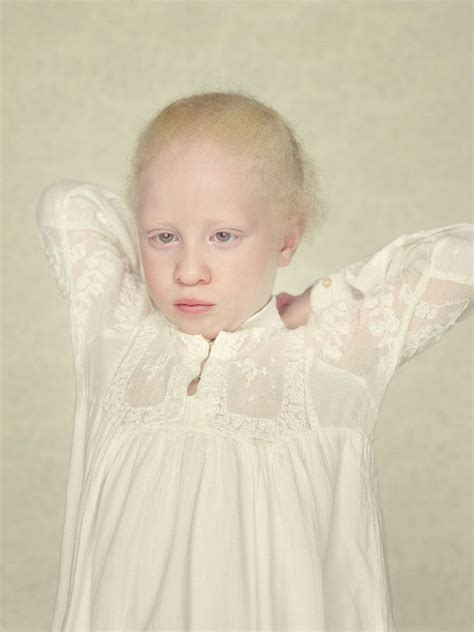Gustavo Lacerda S Rie Intitul E Albinos Sheer Beauty