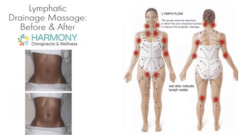 Lymphatic Drainage Massage Kelowna Harmony Chiropractic And Acupuncture Clinic Kelowna Top