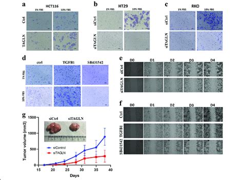 Tagln Promotes Crc Cell Migration And In Vivo Tumor Formation A