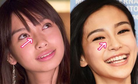652 x 896 jpeg 613 кб. The miraculous transformation of the Angelababy plastic surgery