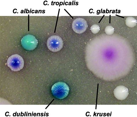 Colonies Of Different Species Of Candida After Growing For 48 H At 37°c