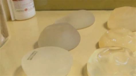 Breast Implants Linked To Rare Cancer Have Been Recalled Worldwide