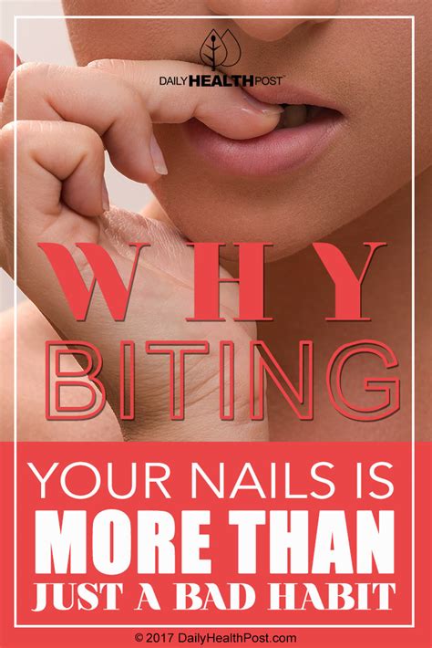 Why Biting Your Nails Is More Than Just A Bad Habit