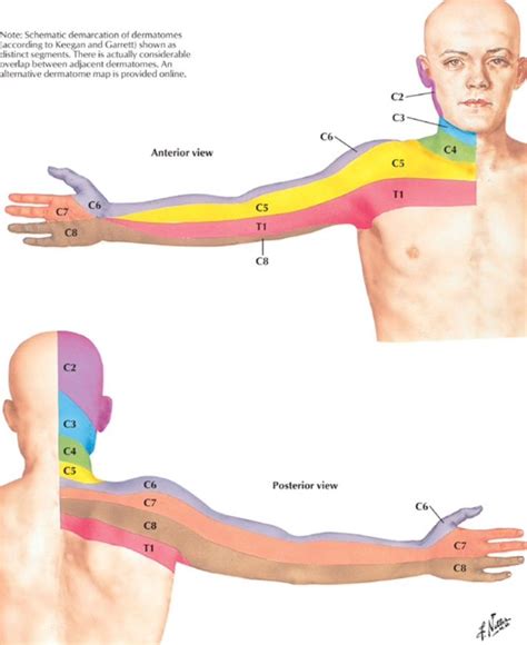 Dermatome Distribution For The Cervical Spine Netter Muscle Anatomy Medical Anatomy Human