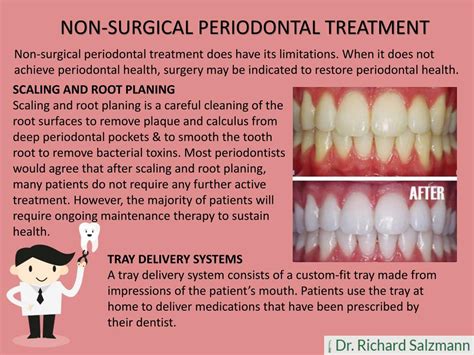 Ppt Periodontal Treatments And Procedures By Dr Salzmann Powerpoint
