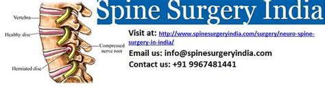 Neuro Spine Surgery Cost In India The Spine Surgery India Flickr
