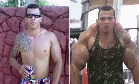 The Horrifying Story Of A Bodybuilder Who Was Addicted To Muscle