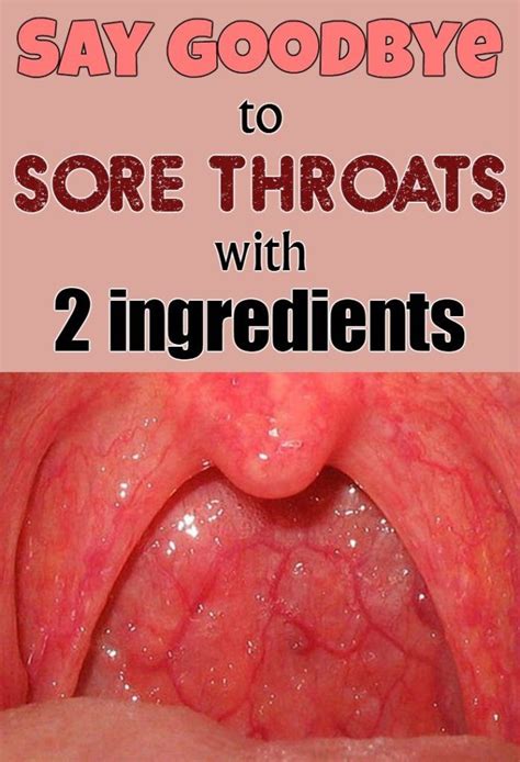 Say Goodbye To Sore Throats With 2 Ingredients Sore Throat Remedies For