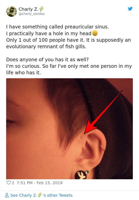 But What If That Tiny Hole Above Your Ear Serves A Purpose 8 Pics 1