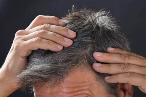 Gray Hair Cure How To Grey Hair Treatment Pill Supplements And Natural Cure For Grey Hair