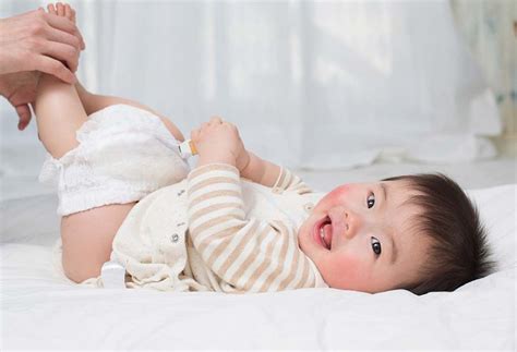 Ruam Popok Pada Bayi Ketahui Gejala Penyebab Dan Cara Mengatasinya