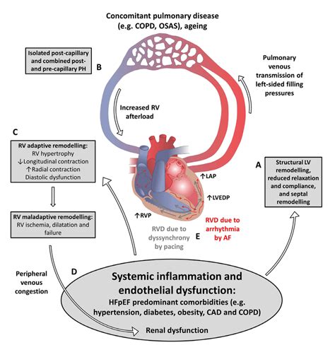 Proposed Framework Of Right Ventricular Dysfunction In Hfpef A One Of