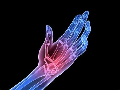 Arthritis Pain And Treatment Omega Pain Clinic Utah