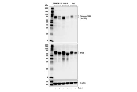 Phospho Tfeb Ser122 Antibody Cell Signaling Technology
