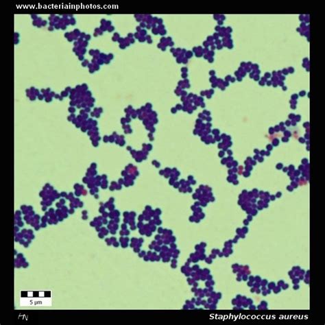 Staphylococcus Aureus Under Microscope