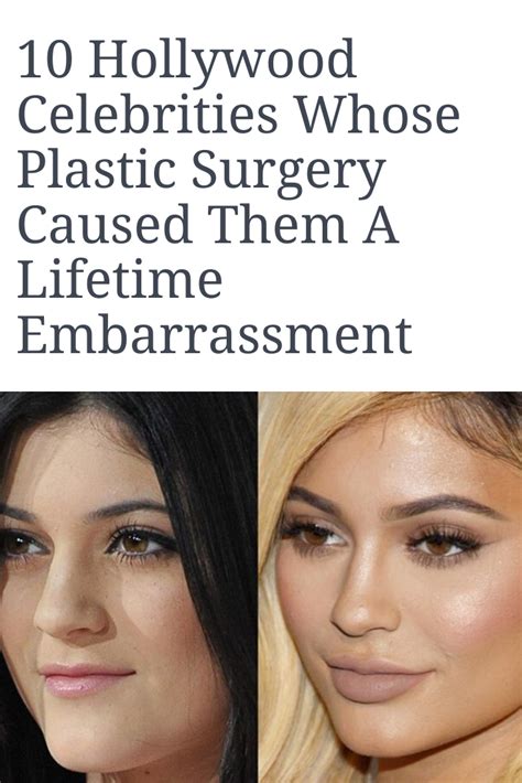 10 Hollywood Celebrities Whose Plastic Surgery Caused Them A Lifetime