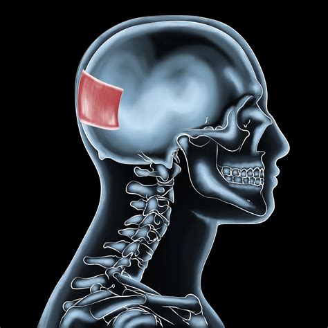 Overcoming Occipitalis Injuries Neck Pain Treatment Insights