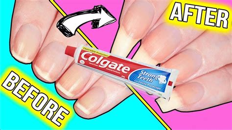 How To Grow Long Strong Nails Fast At Home Colgate Nails Growth