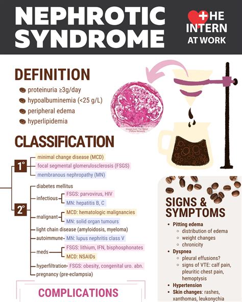 Nephrotic Syndrome — The Intern At Work