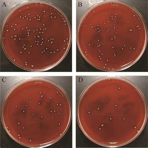 Typical Bacterial Colonies Grown On The Blood Agar Plates At Serial