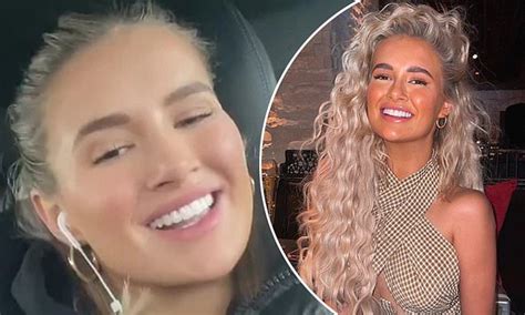 Molly Mae Hague Shows Off Her New Teeth On Mission To Become More Natural