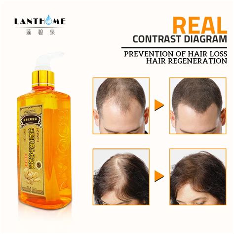 300ml ginger shampoo anti hair baldness anti hair loss dandruff black hair shampoo professional