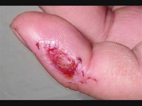 How can a guy finger himself? Finger Cut - Watch my Finger Heal after cutting myself on ...